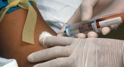 Un test sangvin ar putea detecta din timp cancerul pulmonar - 0b17c3df4005268c403589c52e300809.jpg