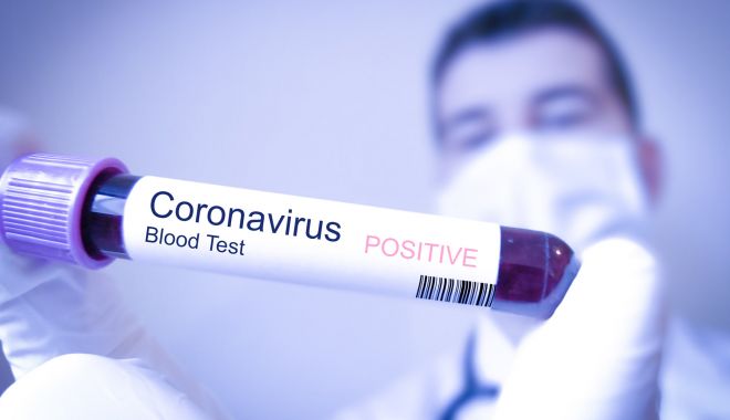 Încă un angajat al Primăriei Constanța, confirmat cu coronavirus - 1-1592576672.jpg