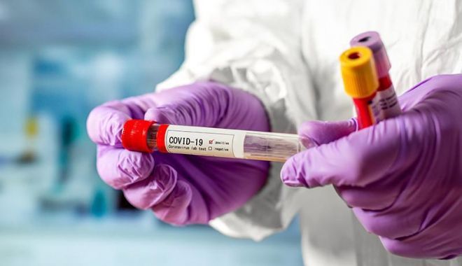 Coronavirus la Constanța. Crește numărul de persoane infectate - 1-1593708000.jpg