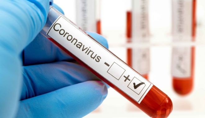 Coronavirus la Constanța. Câte persoane au fost diagnosticate până acum - 1-1594217656.jpg