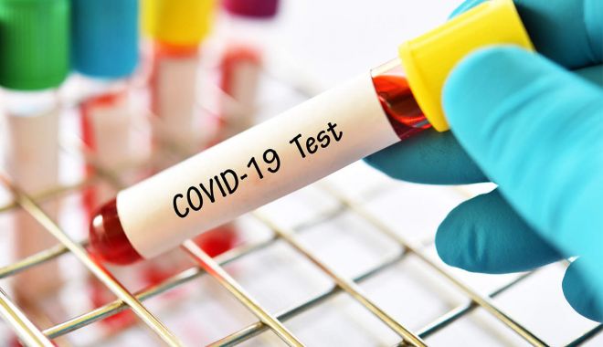 Situația actualizată privind COVID-19 la Constanța. Au fost confirmate 1.543 de persoane infectate - 1-1598458969.jpg