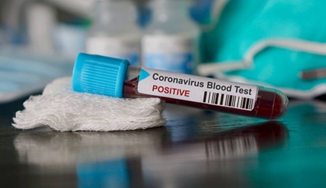 COVID-19. Teste mai puţine: 1.109 cazuri noi, în 24 de ore, 37 la Constanţa - 1-1599991802.jpg