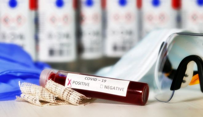 Explozie de cazuri noi de COVID-19, în toată ţara. 65 de noi diagnosticaţi, la Constanţa - 1-1600855931.jpg
