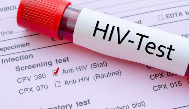 Asociaţia Română Anti-SIDA organizează prima ediţie a Săptămânii Internaţionale a Testării HIV - 1-1606139892.jpg