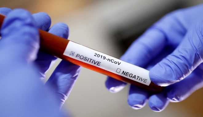 Coronavirus la Constanţa. 17.543 de persoane au fost confirmate cu COVID până în prezent - 1-1606845188.jpg