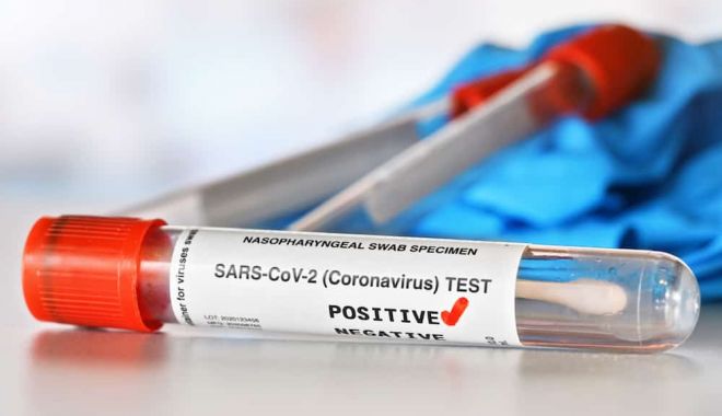 COVID-19. Mai puţine teste, mai puţine cazuri raportate, în ultimele ore - 1-1608463175.jpg