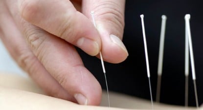 Acupunctura tratează durerile de orice fel - 1000bdd9dc4f3e5599ebcca8e966d5a2.jpg