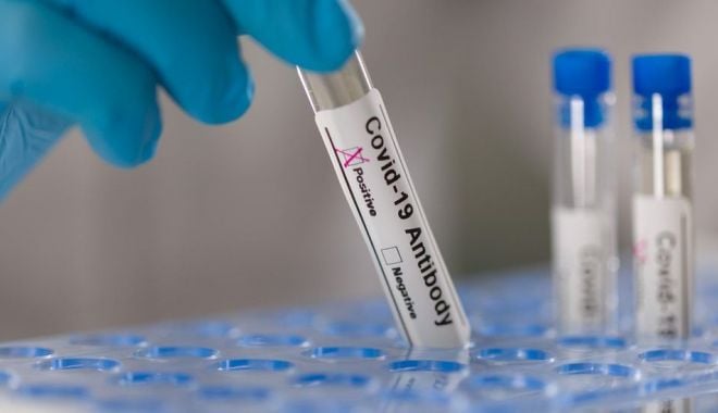 COVID-19. Din ce în ce mai puţine cazuri înregistrate, la Constanţa - 116575817gettyimages1219867193-1619519474.jpg