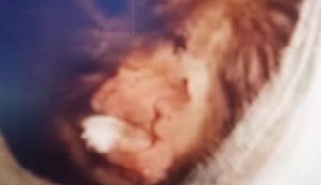 VIDEO. Imagini șocante cu copilul mușcat de un câine, în timp ce venea de la școală - 121-1497439705.jpg