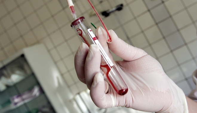 Cutremurător. Cinci pacienți au fost infectați cu HIV prin refolosirea echipamentului - 140306152858hivbloodtestfull169-1486805405.jpg