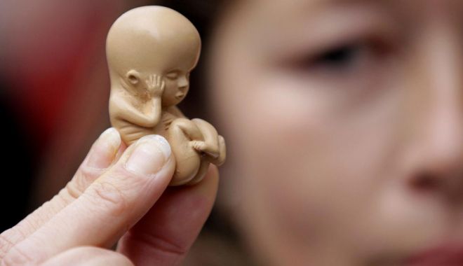 Medicii de la Obstetrică-Ginecologie au decis să refuze avorturile la cerere, invocând motive religioase - 14marturiaunuiavort-1536838121.jpg