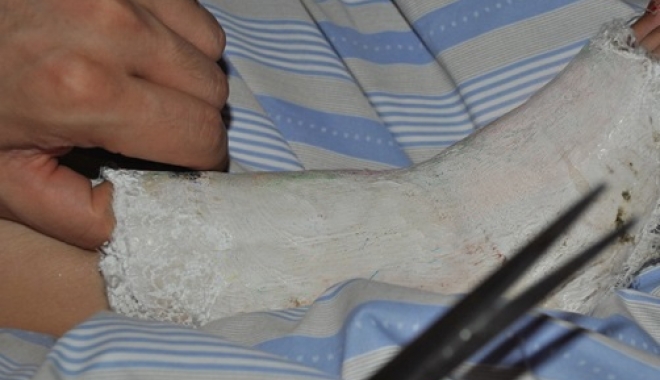 Tânăr MORT de la o ENTORSĂ? Suspiciuni de malpraxis în spital - 188461-1476257311.jpg