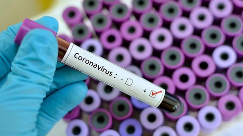 Pandemia de Covid renaște! Număr uriaş de cazuri! Oamenii nu mai au voie să iasă din case - 20200224coronavirusen-1647081444.jpg