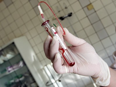 Bolnavii de hepatită și hemofilie, fără tratament - 23-1392986736.jpg