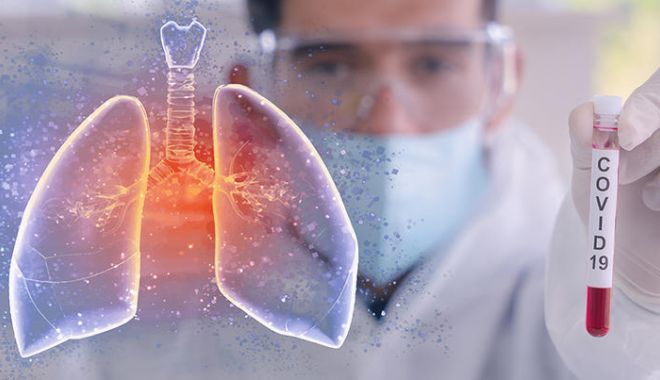 De teamă că are Covid, o profesoară s-a sinucis, înainte să primească rezultatul testului - 23articolmediccovid-1599729681.jpg