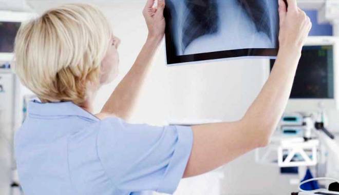 Investigații pentru depistarea cancerului pulmonar, la MEDSTAR 2000 - 26apriliemedstarcancer-1430039377.jpg