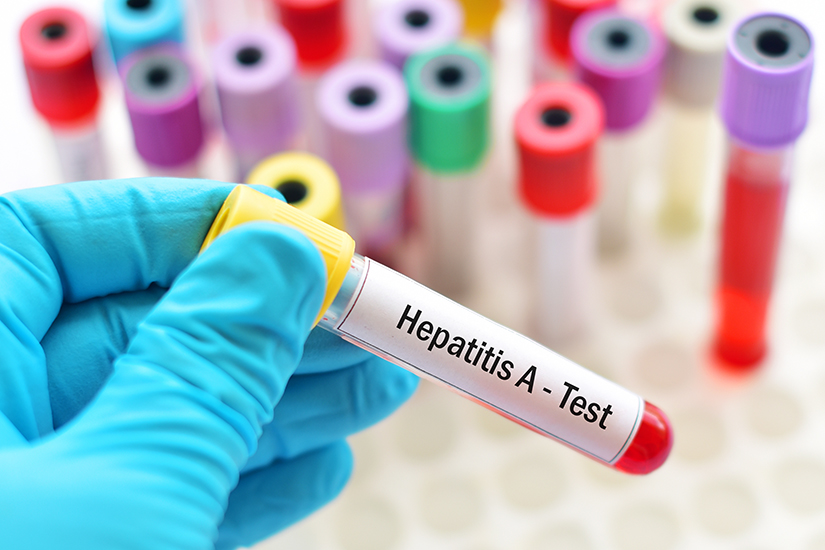 Alertă epidemiologică: 131 de cazuri de hepatita A - 26articolanalizeheptatitaa-1759384757.jpg