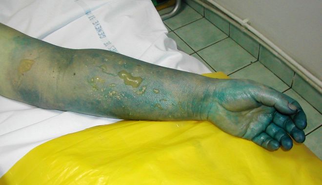 UN MEDIC TRAGE UN SEMNAL DE ALARMĂ! 