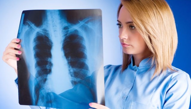 Nefumătorii prezintă risc foarte scăzut de cancer pulmonar - 324060l640x0w93cb44ed-1505212601.jpg