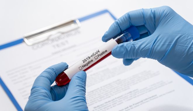 Câte teste pentru coronavirus au fost efectuate până acum în România - 3522834-1585840674.jpg