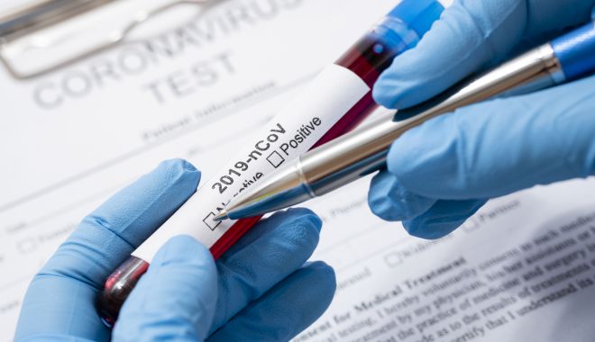 Trei cazuri noi de infectare cu coronavirus, în județul Constanța - 3522960-1589538004.jpg