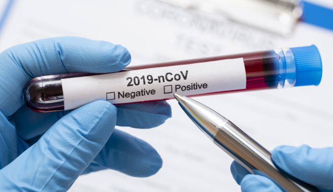 DOUĂ CAZURI NOI DE CORONAVIRUS la Constanța! Soț și soție, depistați pozitiv după o călătorie în Austria - 3522979-1584191272.jpg