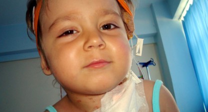Are doi ani și jumătate și suferă de leucemie - 3d93dff0744dbe667f649ed61dee5706.jpg