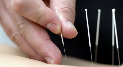 Constănțenii pot face acupunctură pe banii statului - 4e9c0297ab1b247dfe60286c469953a3.jpg