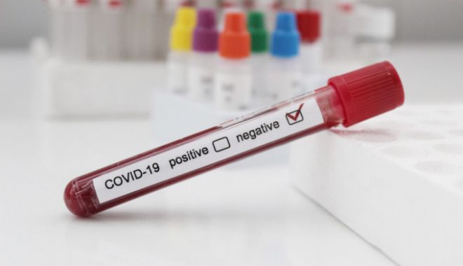 Avocatul Poporului consideră excesivă condiționarea salariatului de a prezenta un test negativ de COVID-19 - 62137276-1596625240.jpg