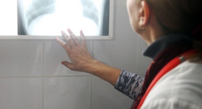 Cei care scuipă pe stradă vă pot îmbolnăvi de TBC - 63c27708f9cf591e878c155f23c25b5a.jpg