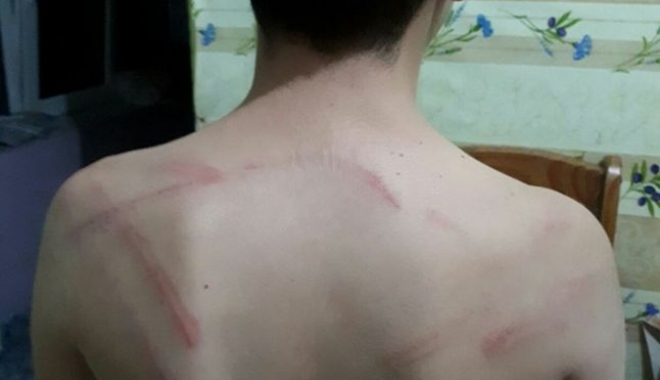 COPIL BĂTUT PÂNĂ LA SÂNGE, CU O NUIA, CHIAR DE TATĂL SĂU. AGRESORUL, RECLAMAT DE SOȚIE - 646x404-1507029166.jpg