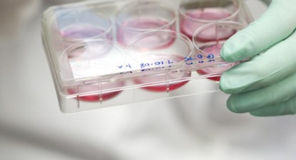 Donarea de celule stem, realizată printr-un procedeu similar donării de sânge - 6a59bb58c6c03d5103d44f3b7e5ebf07.jpg