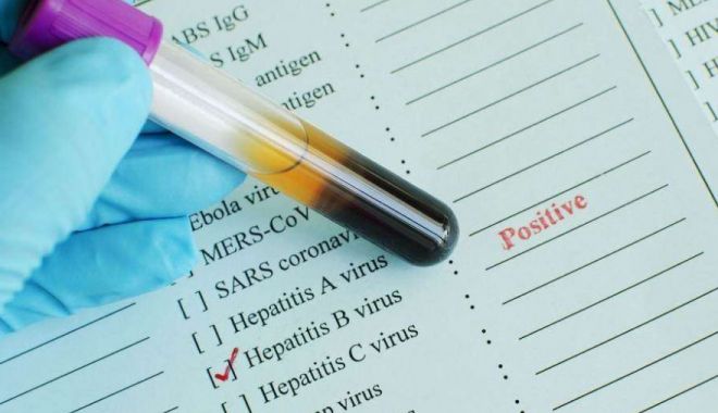 VEȘTI BUNE PENTRU BOLNAVII DE HEPATITĂ - 7200231522830644doar10dintreroma-1532675648.jpg