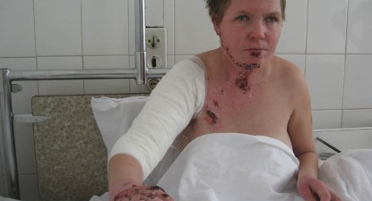 Bărbatul care și-a incendiat concubina rămâne cu pedeapsa de șapte ani și jumătate de închisoare - 77b8d9f826278dc832c9ca6ce527f4cd.jpg