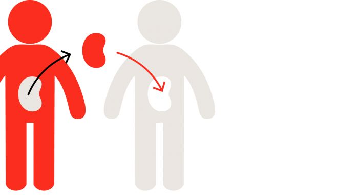 Germania și Ungaria ne vor prelua pacienții care au nevoie de transplant - 92illustrationsall41-1533290687.jpg