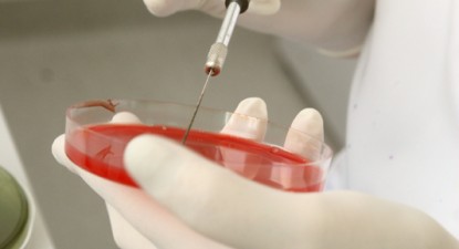 Doar 130 de constănțeni sunt donatori de celule stem - 9d2a55e022c81f34efea658e08a1f8f3.jpg