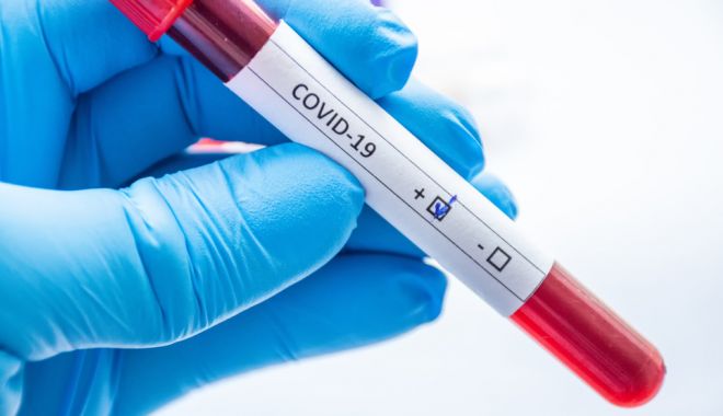 Coromavirus la Constanța. Au fost confirmate 25.904 de cazuri de COVID până în prezent - a036b2469e3d423ea8285aa2593d783b-1609361703.jpg