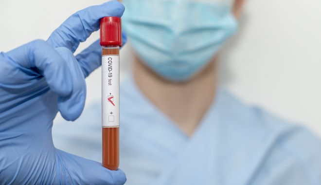 COVID-19. O nouă creştere a numărului de infectări noi: 1.380 de cazuri, în ţară, 21 la Constanţa - a9dd69cb8b35ddbafc2b439a83389ea7-1599732921.jpg