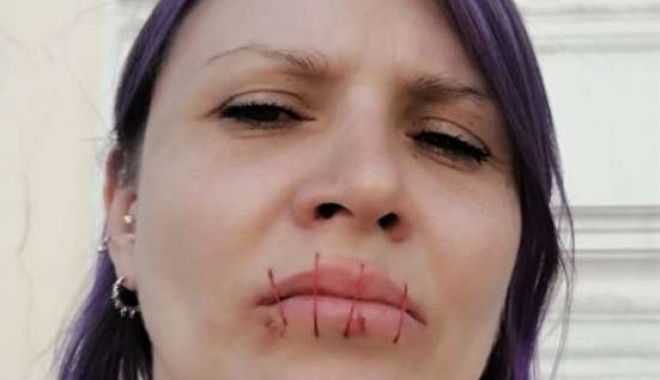 IMAGINEA ZILEI. O activistă rusă şi-a cusut gura în semn de protest faţă de războiul din Ucraina - activistaguracusuta-1651735833.jpg