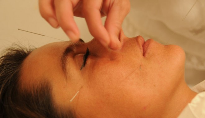 Acupunctura, terapia lui Ying și Yang - acupunctura-1348153118.jpg