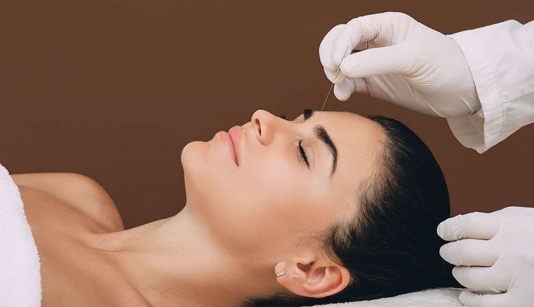 Acupunctura este dureroasă doar atunci când nu este realizată corect - acupunctura-1742298654.jpg