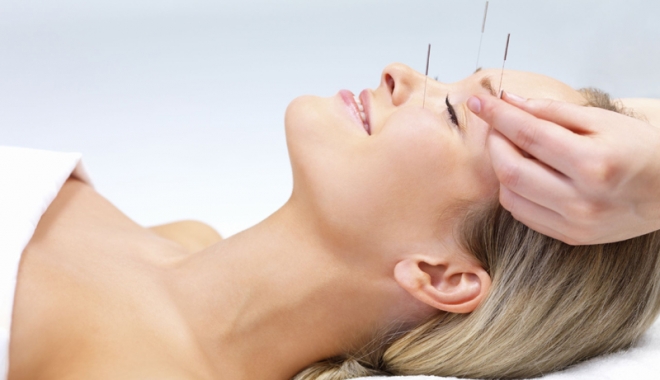 Acupunctura, tratamentul ce poate înlocui pastilele analgezice - acupuncture-1471619522.jpg