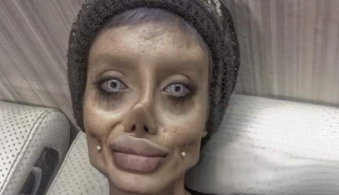 Fotografiile cu o tânără care spunea că și-a făcut 50 de operații estetice pentru a arăta ca Angelina Jolie sunt false - agfzad1jyju0owjhzdnmmtmzzjk5ote2-1512651654.jpg