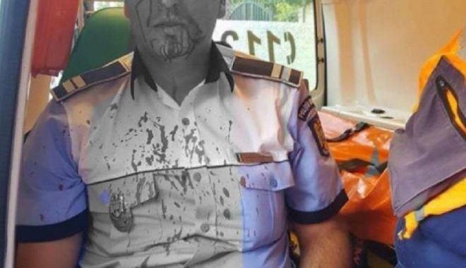 Un polițist a fost lovit în cap în timp ce încerca să imobilizeze un bărbat agresiv - agresiune-1594550875.jpg