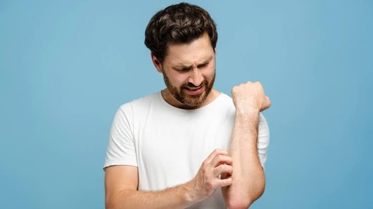 Vi se irită pielea după haine proaspăt spălate? Cum recunoașteți alergia la detergent - alergie-1783339159.webp