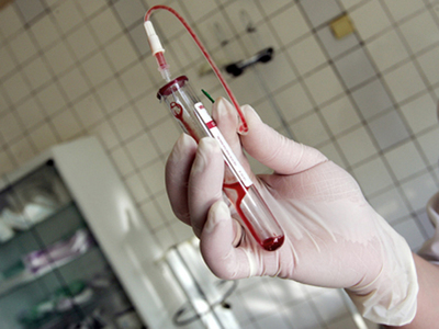 Și-a injectat soția gravidă cu sânge infectat cu HIV. Motivul este revoltător! - analizasange-1370183646.jpg