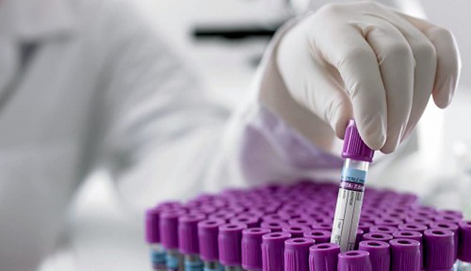7.000 de pacienți testați pentru HIV  și hepatită de Fundația Baylor - analize-1369366515.jpg