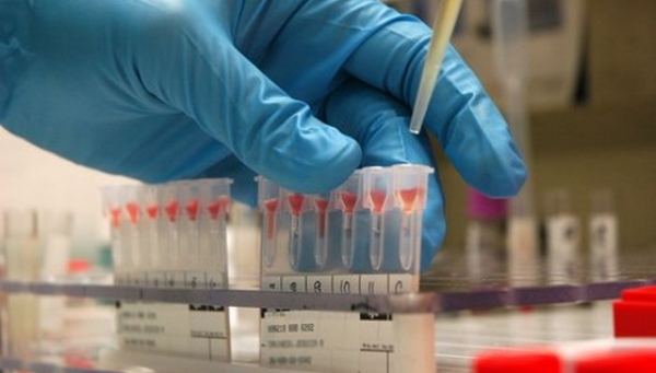 A fost identificat românul care a dus rujeola în Ungaria - analizemedicale-1489155920.jpg