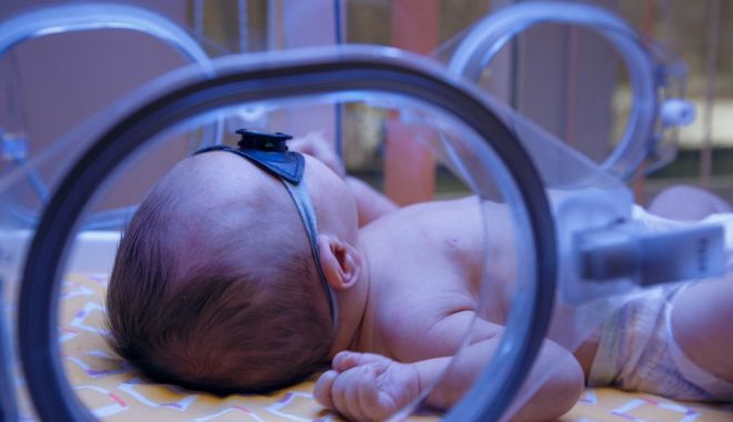 Anemia neonatală poate avea diverse cauze severe - anemia-neonatala-1689097073.jpeg