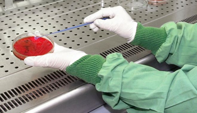 ALERTĂ medicală în România: Un bărbat este suspect de antrax - antrax-1665585611.jpg